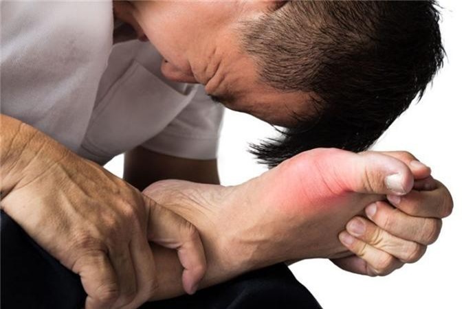 Bí quyết điều trị và giảm đau khớp ngón chân hiệu quả - Ảnh 3 dau khop ngon chan3