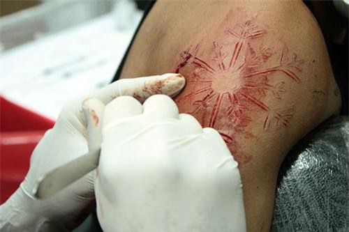 Nhiều nguy cơ tiềm ẩn khi xăm mình