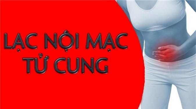 Tất tần tật những điều cần biết về đau eo lưng bên phải - Ảnh 7 dau eo lung ben phai7