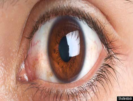 Vì sao chúng ta lại nháy mắt nhiều?