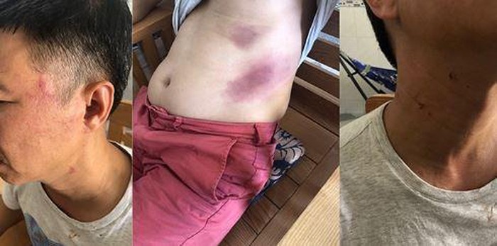 CA tỉnh Kiên Giang vào cuộc vụ đại úy Phạm Quốc Hưng bị tố lừa đảo chiếm đoạt tài sản