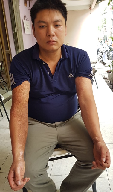 Cựu binh tâm thần 9 lần tự tử đòi công lý