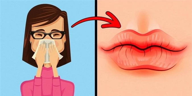 8 điều mà đôi môi đang hé lộ sức khỏe có vấn đề mà bạn mảy may không biết
