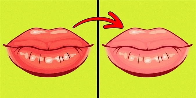 8 điều mà đôi môi đang hé lộ sức khỏe có vấn đề mà bạn mảy may không biết