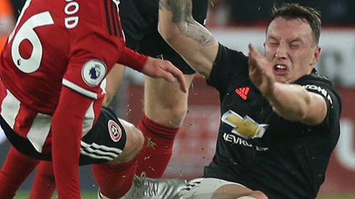 Phil Jones: Gã hề đáng thương trong nhà hát của ác mộng