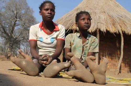 Bộ lạc "chân đà điểu" kỳ lạ ở châu Phi