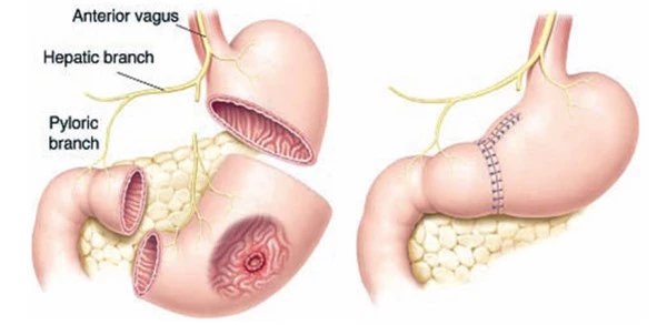 Lần nào ăn cháo xong cũng bị ngất xỉu, phải đến khi cầu cứu bác sĩ thì người phụ nữ mới biết được một sự thật bất ngờ - Ảnh 5.