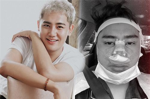 Duy Plue - bạn thân loạt hot girl: Đã từng nặng đến 134kg, tủm tỉm cười rồi lại khóc sau ca PTTM thay đổi cuộc đời