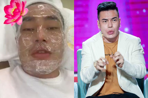 Lê Dương Bảo Lâm gây sốc kể thay 3 bộ răng sứ, sóng mũi bị hư hỏng nặng vì phẫu thuật giá 10 triệu