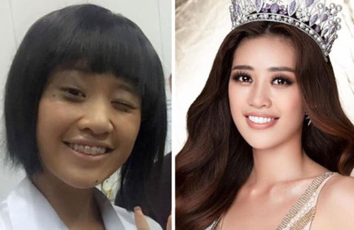 Ảnh hiếm thời còn niềng răng của Khánh Vân hot trở lại chứng minh Tân Hoa hậu dậy thì quá thành công