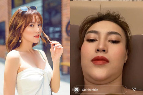 Còn đâu hình ảnh "ngọc nữ" kiêu sa, Ninh Dương Lan Ngọc lộ chiếc cằm nọng và gương mặt béo múp míp