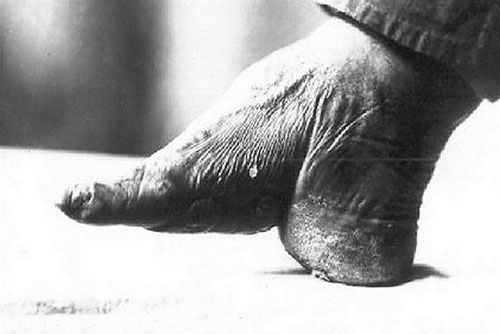 Muôn chiêu làm đẹp đáng sợ của phụ nữ xưa