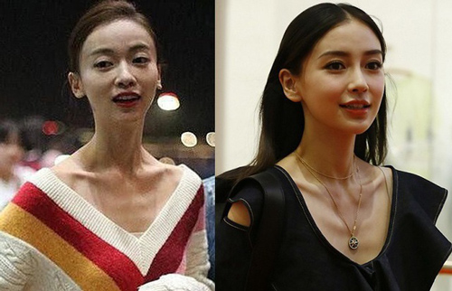 Hốt hoảng trước những hình ảnh trơ xương của loạt mỹ nhân Cbiz, netizen Hàn phải thốt lên: "Không phải gầy bình thường mà là gầy xơ gầy xác"