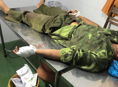 Đắk Lắk: Hàng chục lâm tặc hung hãn vây chém kiểm lâm, giải cứu đồng bọn