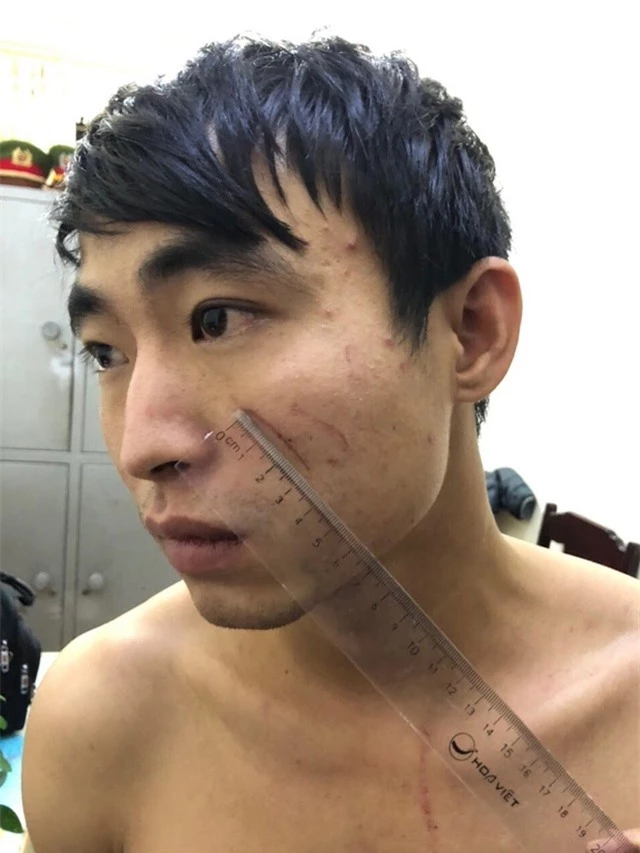 Nghi phạm giết bạn gái trong nhà nghỉ ở Sầm Sơn khai do dùng ma túy đá - 1