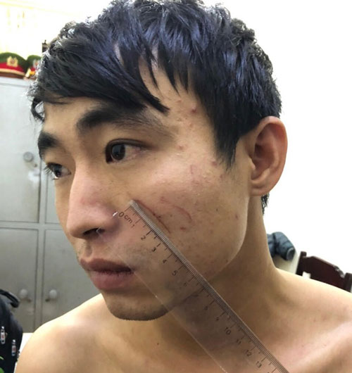 Thanh Hóa: Nghi phạm giết bạn gái trong nhà nghỉ ở Sầm Sơn khai do dùng ma túy đá