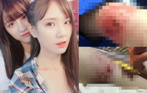 Biến căng: Idol girlgroup ngầm tố cáo bị thành viên cùng nhóm đánh đập dã man, cả 2 từng là cặp đôi siêu hot