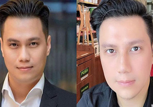 Việt Anh và cuộc "dao kéo" ồn ào nhất Vbiz năm 2019