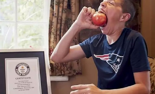 Bé 14 tuổi phá kỷ lục thế giới nhờ miệng rộng