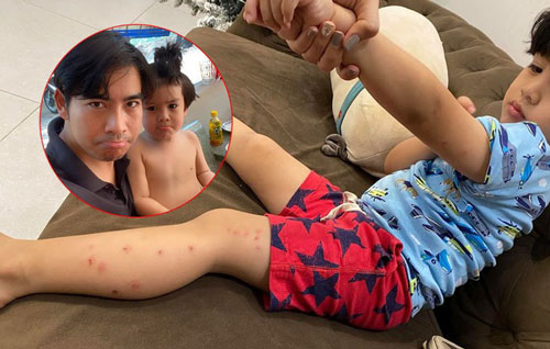 Ngọc Lan có động thái gay gắt khi phát hiện những vết đỏ chi chít trên người con trai sau khi đi chơi với bố