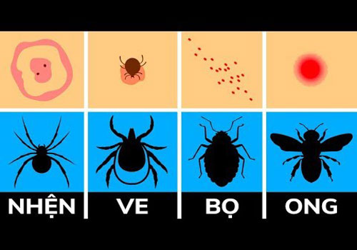 CLIP: Cách xác định và xử lý vết côn trùng đốt