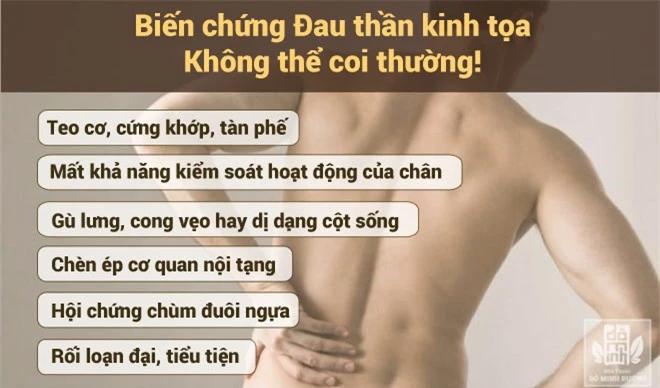 Đau thần kinh tọa: Triệu chứng và bài thuốc chữa trị hiệu quả tư vấn bởi chuyên gia - 3