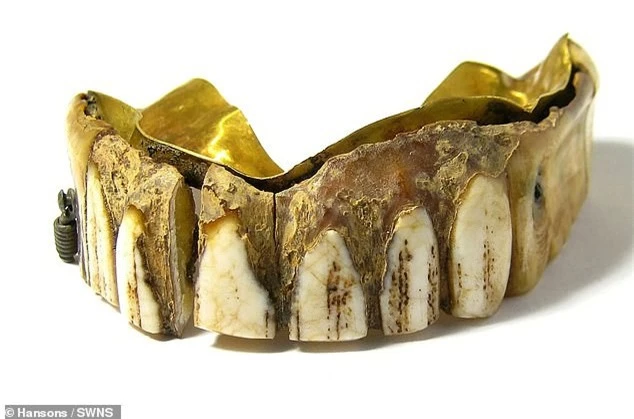Hàm răng giả gắn vàng 200 năm tuổi giá ước tính hàng trăm triệu đồng - ảnh 1