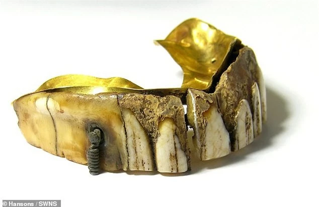 Hàm răng giả gắn vàng 200 năm tuổi giá ước tính hàng trăm triệu đồng - ảnh 2