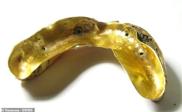 Hàm răng giả gắn vàng 200 năm tuổi giá ước tính hàng trăm triệu đồng - ảnh 4