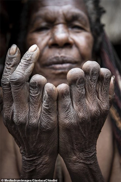 Bàn tay của một phụ nữ lớn tuổi. Có thể thấy bà đã mất đi 6 người thân của mình.
