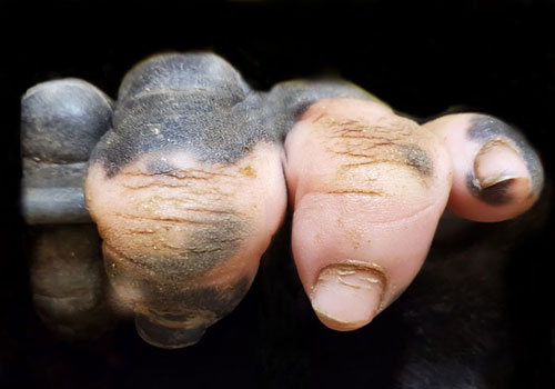 "Soi" khỉ đột bạch biến giống con người đến khó tin