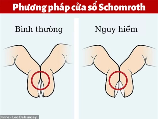 Chỉ một thao tác đơn giản với ngón tay có thể biết mình có mắc ung thư phổi hay không - 1