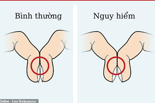 Chỉ một thao tác đơn giản với ngón tay có thể biết mình có mắc ung thư phổi hay không
