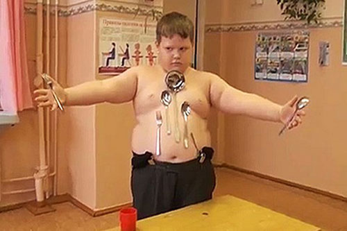 Cậu bé 12 tuổi có khả năng hút kim loại sau khi bị giật điện