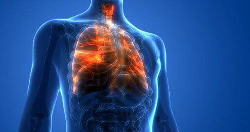 Những căn bệnh gây tử vong hàng đầu trên thế giới