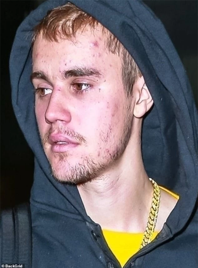 Bao năm bị tố lạm dụng ma tuý đá, Justin Bieber tiết lộ tình trạng sức khoẻ thật sự khiến nhan sắc tàn tạ  - Ảnh 1.