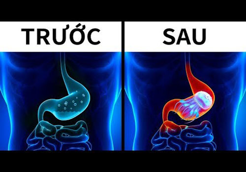 CLIP: Điều gì sẽ xảy ra nếu bạn nuốt một con sứa?