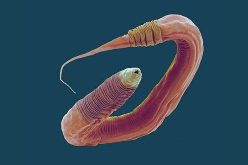 Chỉnh sửa gen giúp các nhà khoa học tăng 500% tuổi thọ của giun, tương đương 400 năm ở con người