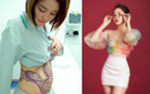 Hotgirl Trâm Anh khoe eo thon sau khi hút mỡ bụng 3 tháng