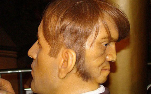 Người đàn ông có gương mặt phụ nữ sau gáy khiến nhiều người khiếp sợ