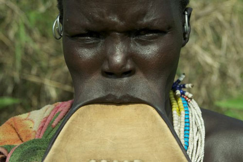 Quái chiêu quàng miệng làm đẹp