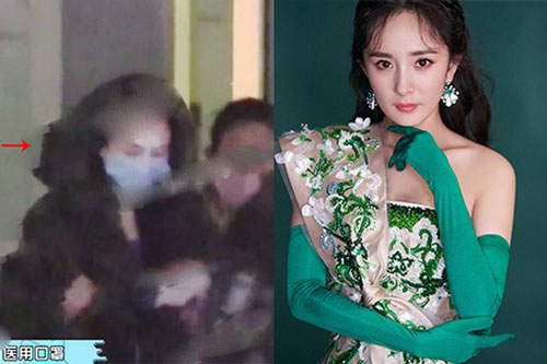 Dương Mịch phẫu thuật thẩm mỹ?