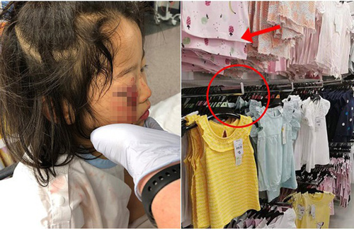 Bé gái bị mù tạm thời một bên mắt vì thứ siêu thị nào cũng có, cha mẹ đưa con đi mua sắm ngày Tết cần lưu ý