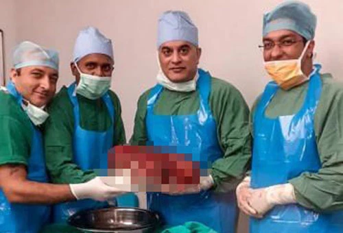 Các bác sĩ chụp ảnh cùng quả tận nặng 7,4kg. Ảnh: Bệnh viện Sir Ganga Ram