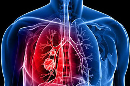 Ăn mỗi ngày loại rau thần dược này để giải độc, ngừa gan nhiễm mỡ