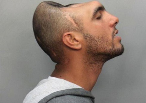 Những 'quái nhân' vẫn sống khi đã mất một phần đầu