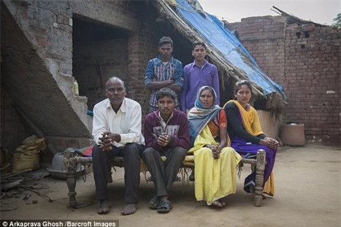 Chàng trai Ấn Độ khốn khổ vì sống chung với 4 chân - ảnh 3