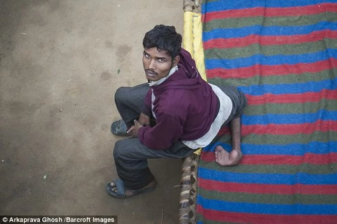 Arun Kumar, 22 tuổi người Ấn Độ sinh ra đã có 4 chân Arun Kumar, 22 tuổi người Ấn Độ sinh ra đã có 4 chân