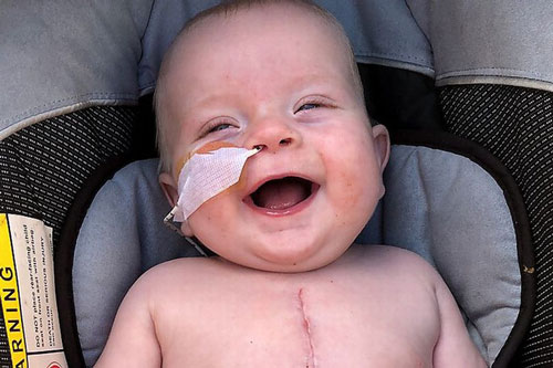 Cứu sống bé trai 5 tháng tuổi nhờ trái tim bê