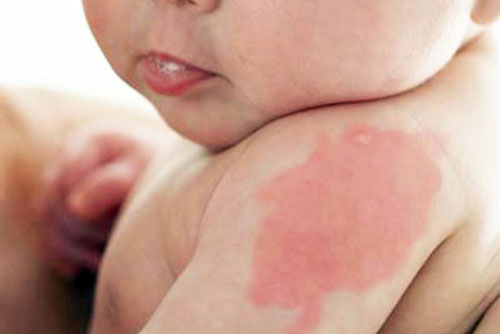 Giải mã hiện tượng sinh con khó nuôi